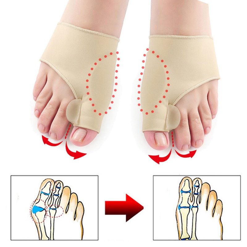 2pcs = 1 par separador do dedo do pé hallux valgus joanete corrector ortopedia pés ajuste do polegar correção pedicure alisador meia